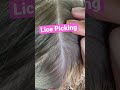 Lice Picking 🐜 l Pulling Small Louse Out of Hair 💇 l Lice Removal Service @staceythelouselady