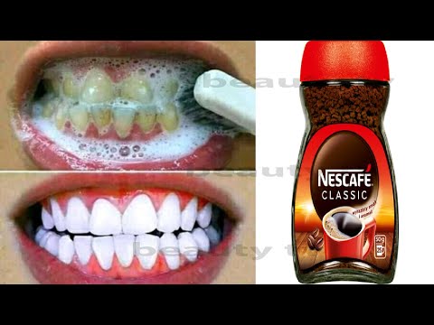 Teeth whitening in one minute - removes yellowing and built up tartar? 100% efficient