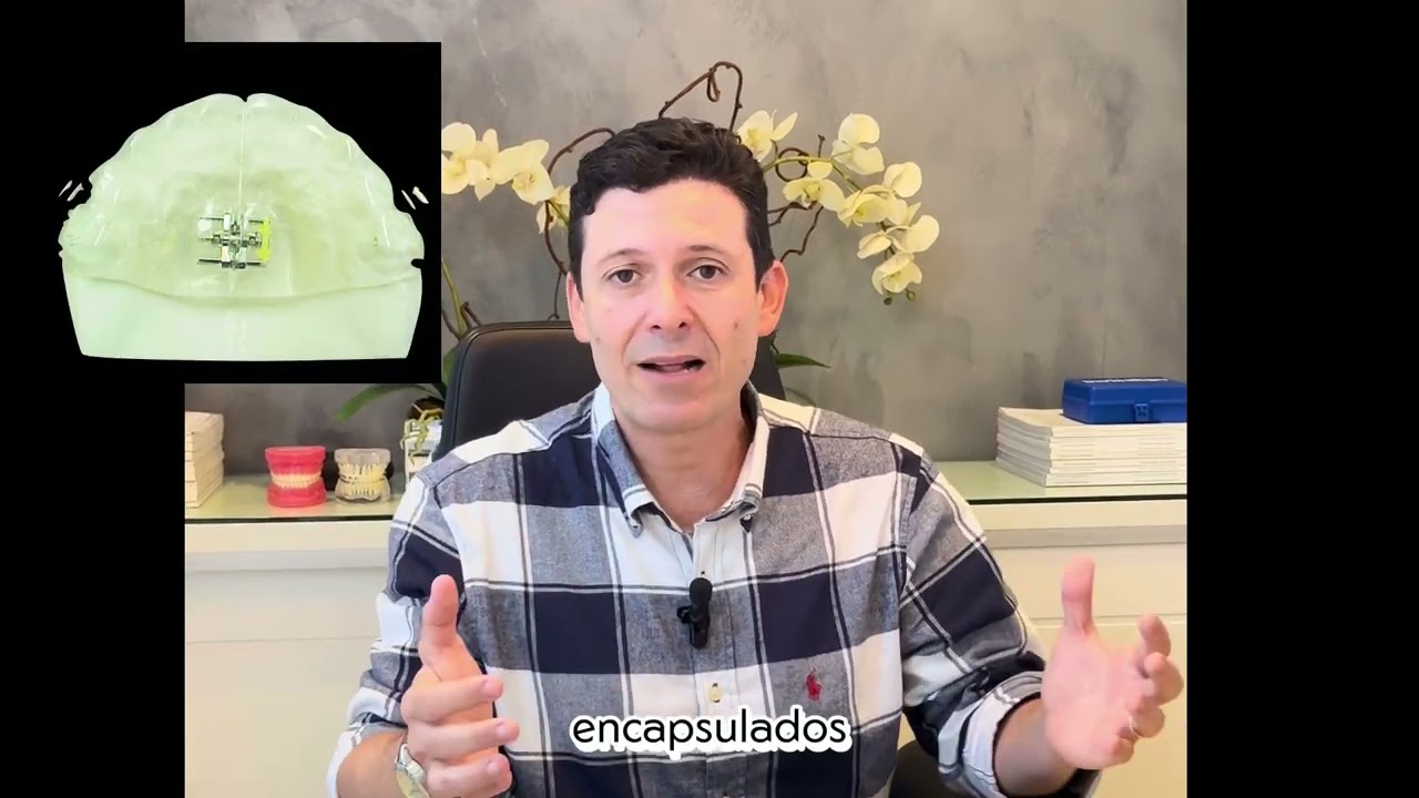 Mordida Cruzada Posterior  - Idade Ideal