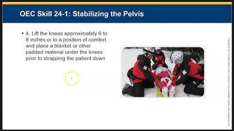 Chap 24.6 Skill 24-1 Application of a pelvic binder
