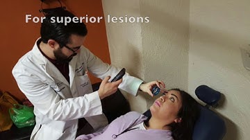 Peripheral fundus photography with a Smartphone-based technique