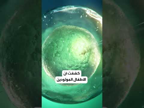 دراسة حديثة تكشف عن مرض خطير يتعرض له أطفال التلقيح الصناعي دون غيرهم