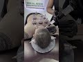 من برّا مرتّب و من جوا موجوع؟ خلي الحجامة ترجّع التوازن لمحلو الصح #massage #hijama #relax