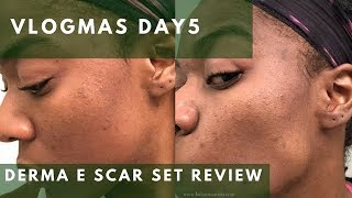 DERMA E SCAR SET 30 DAY REVIEW | VLOGMAS DAY 5