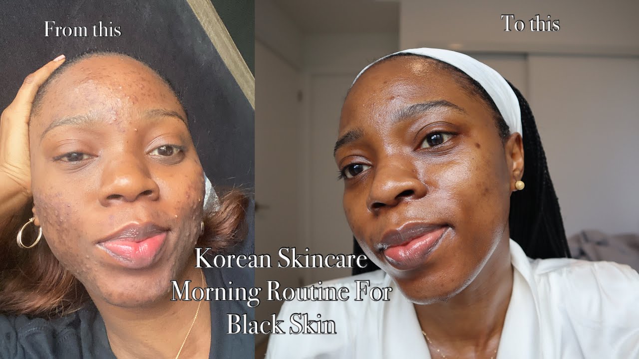 KOREAN SKINCARE MORNING ROUTINE FOR BLACK ACNE PRONE SKIN - YouTube
