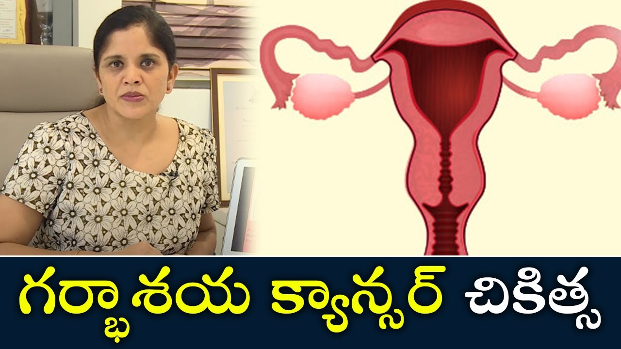 Treatment for Cervical Cancer | గర్భాశయ క్యాన్సర్ చికిత్స | Samayam Telugu