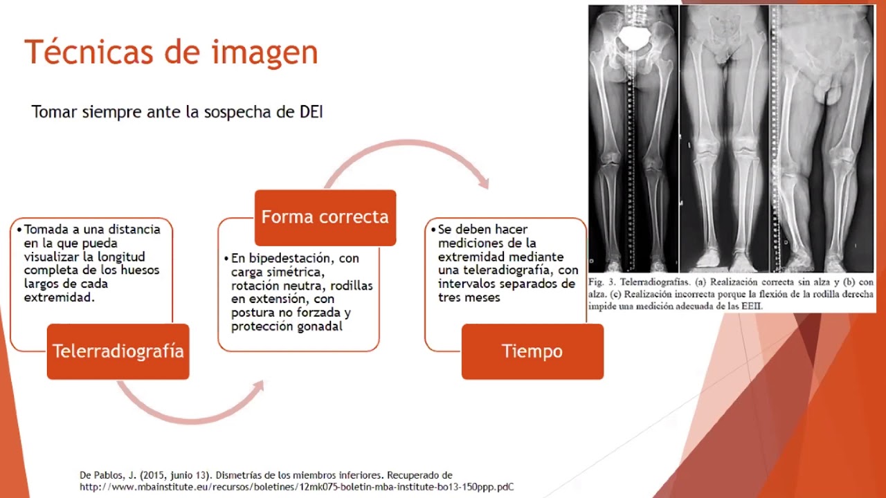 Medicion Real Y Aparente De Miembros Inferiores www.youtube.com