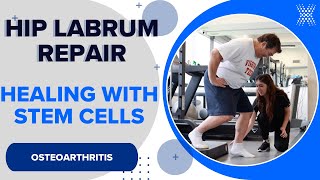 Torn Hip Labrum Recovery A Patients Journey With Stem Cells