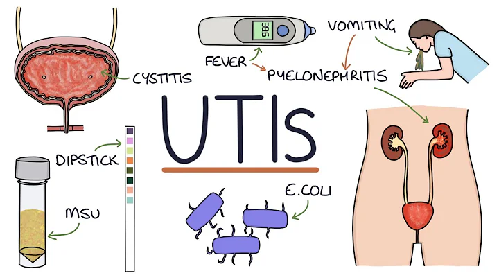 Understanding Urinary Tract Infections - DayDayNews