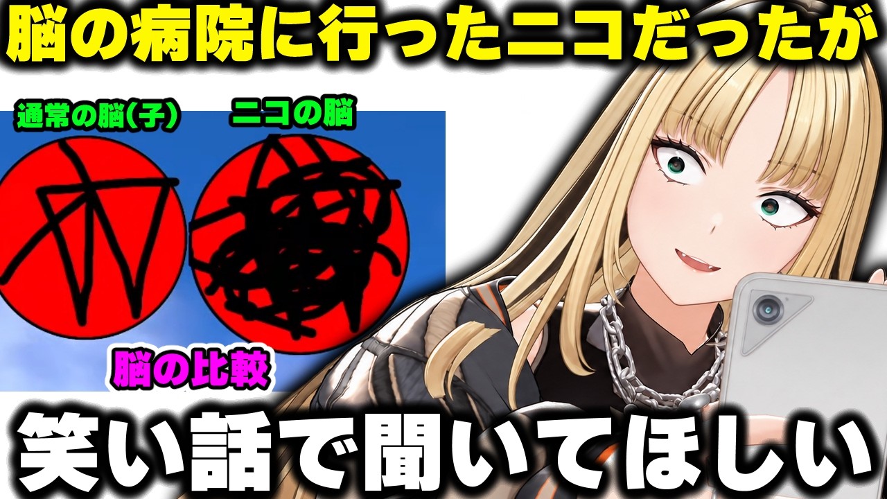 脳の病院に行った結果。脳波計が凄いことになっていたニコwwww【ホロライブ/切り抜き/虎金妃笑虎】