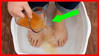 revive tired feet and eliminate toxins with this diy foot detox soak