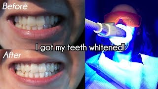 Teeth Whitening Without Sensitivity! | MINT SMILE BAR