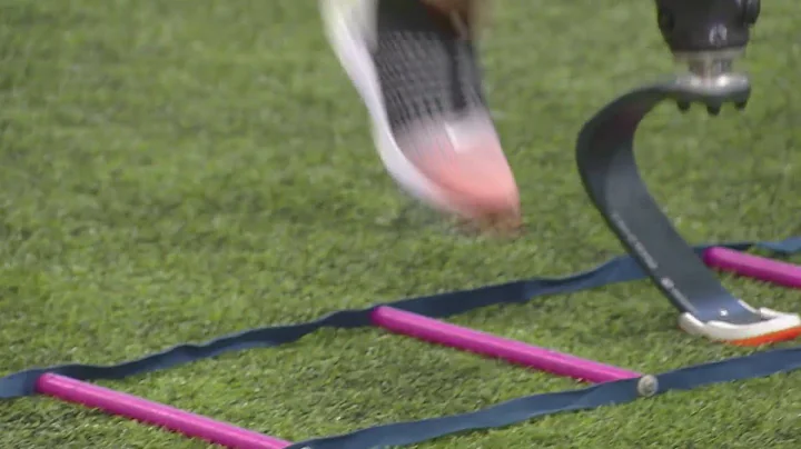 Amputee father participates in his kids' athletics with affordable prosthetic blade