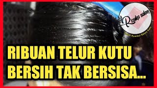 CARA INSTAN MEMBERSIHKAN KUTU RAMBUT (BERSIH SAMPAI TELUR-TELURNYA...)