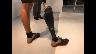 Une prothèse de jambe unique au monde, conçue par une entreprise de Bourgogne Franche-Comté