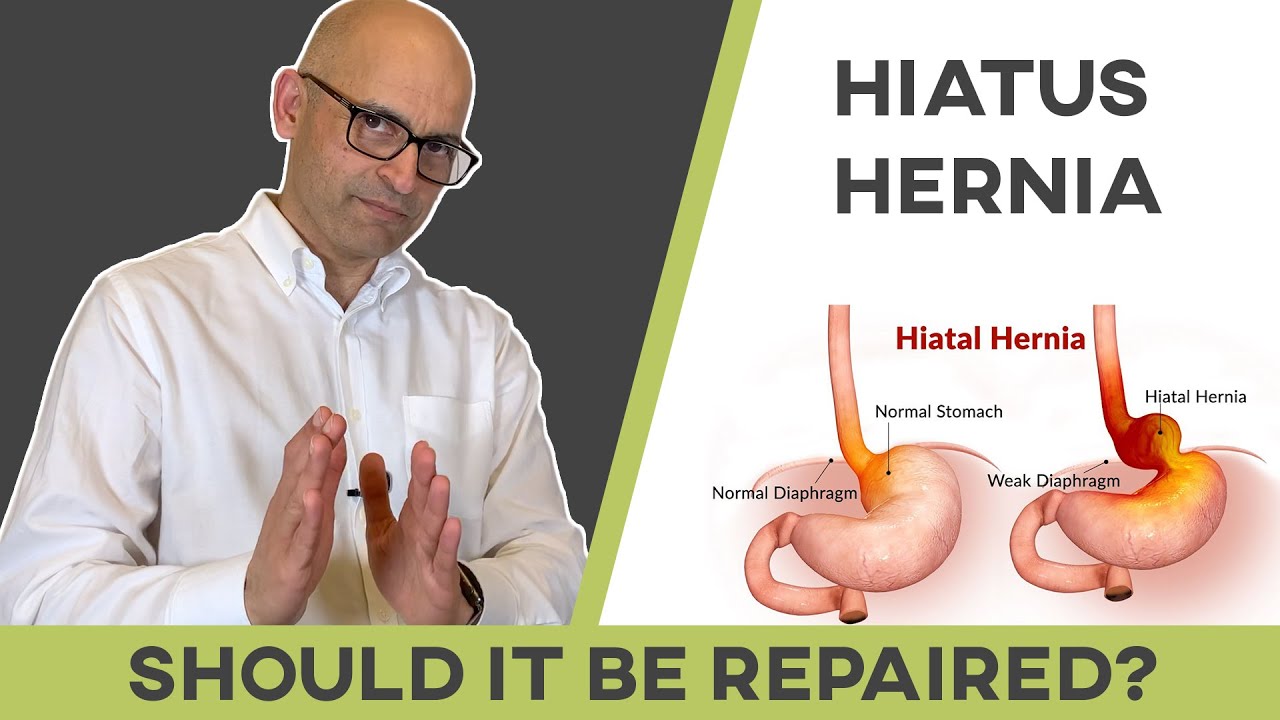 Hiatal Hernia