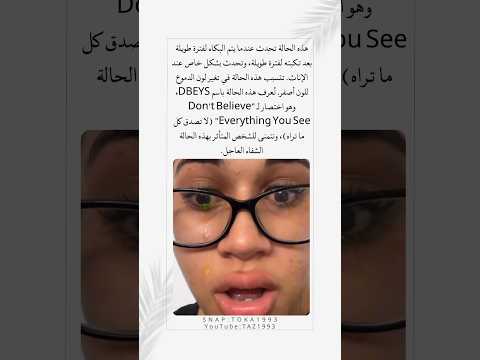 حالة نادرة تجعل الدموع تتحول إلى  غرائب العالم اللون الأصفر حقائق وتفسيرات