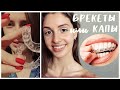 БРЕКЕТЫ или КАПЫ? ОРТОДОНТ СЛОМАЛ МНЕ ЗУБ? ♡ Лиза Сахар