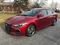 2017 Hyundai Elantra Sport Walk Around