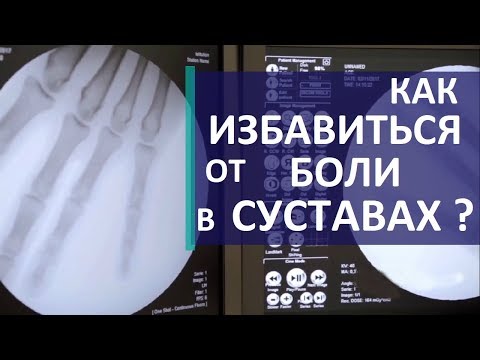 Боли в суставах причины. 💪 Диагностика причин боли в суставах. Скандинавский центр здоровья.