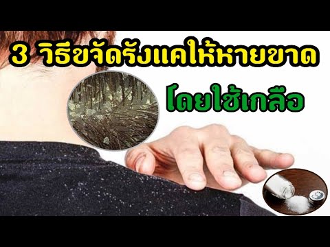 วิธีดูแลปัญหารังแคโดยการใช้เกลือ ขจัดรังแค |AppleStory