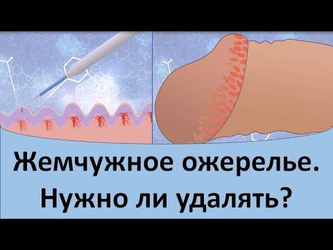 Видео: Обрезание ожерелья