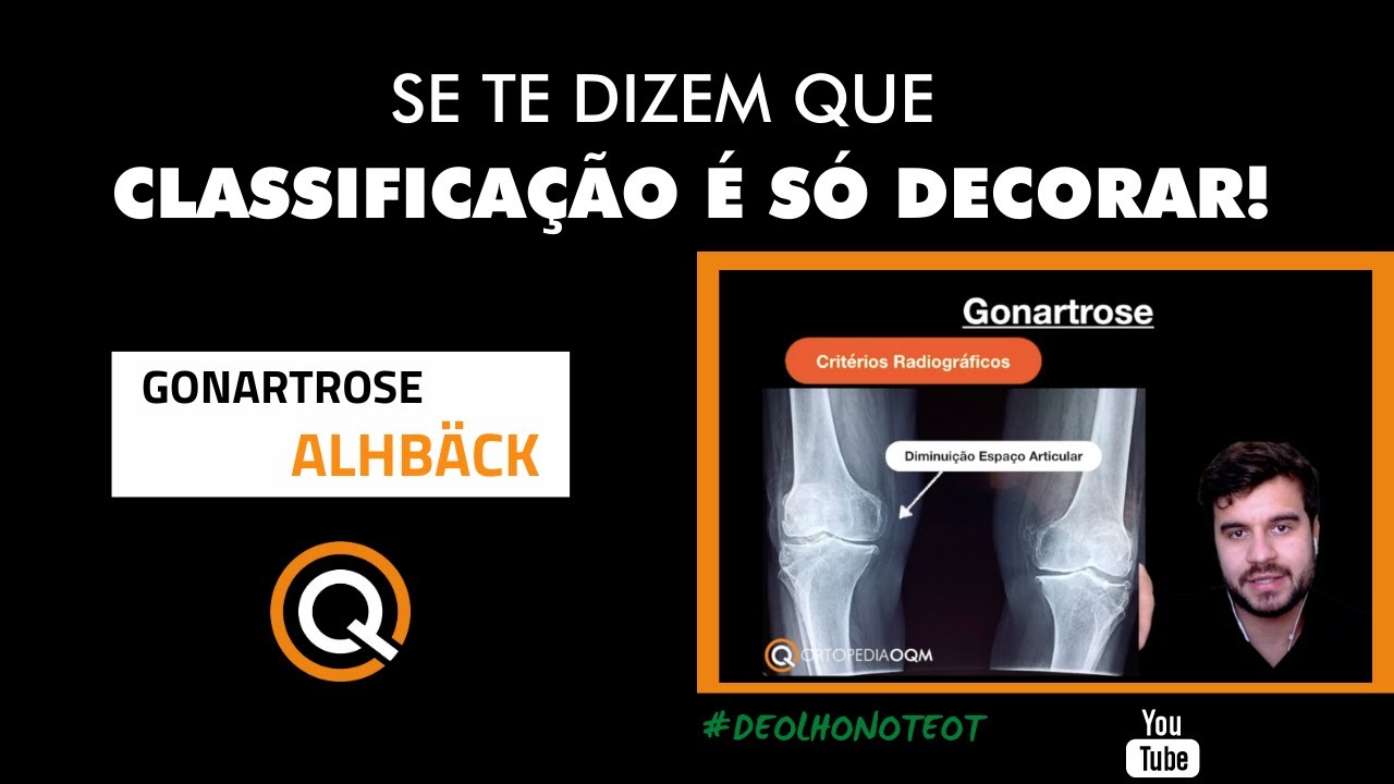 Classificação é só decorar? Gonartrose x Alhback. #DeOlhoNoTEOT - YouTube