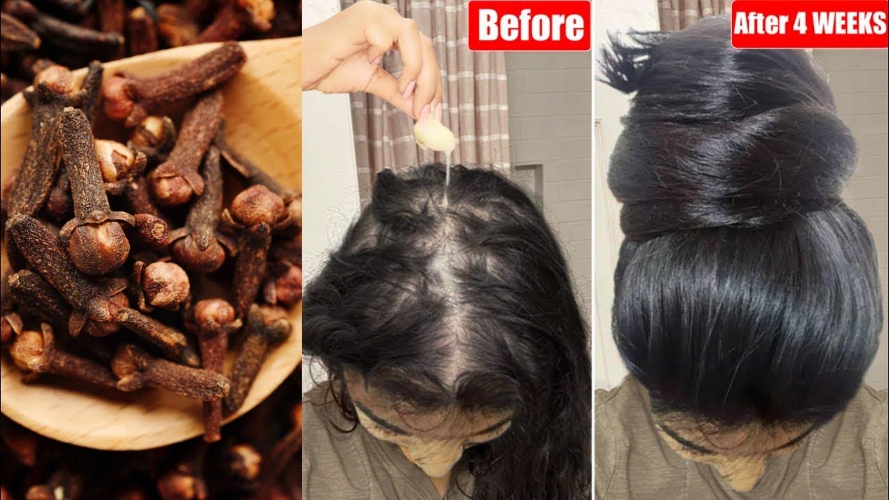 Top Way To Properly Use Cloves For Fast Hair Growth YouTube