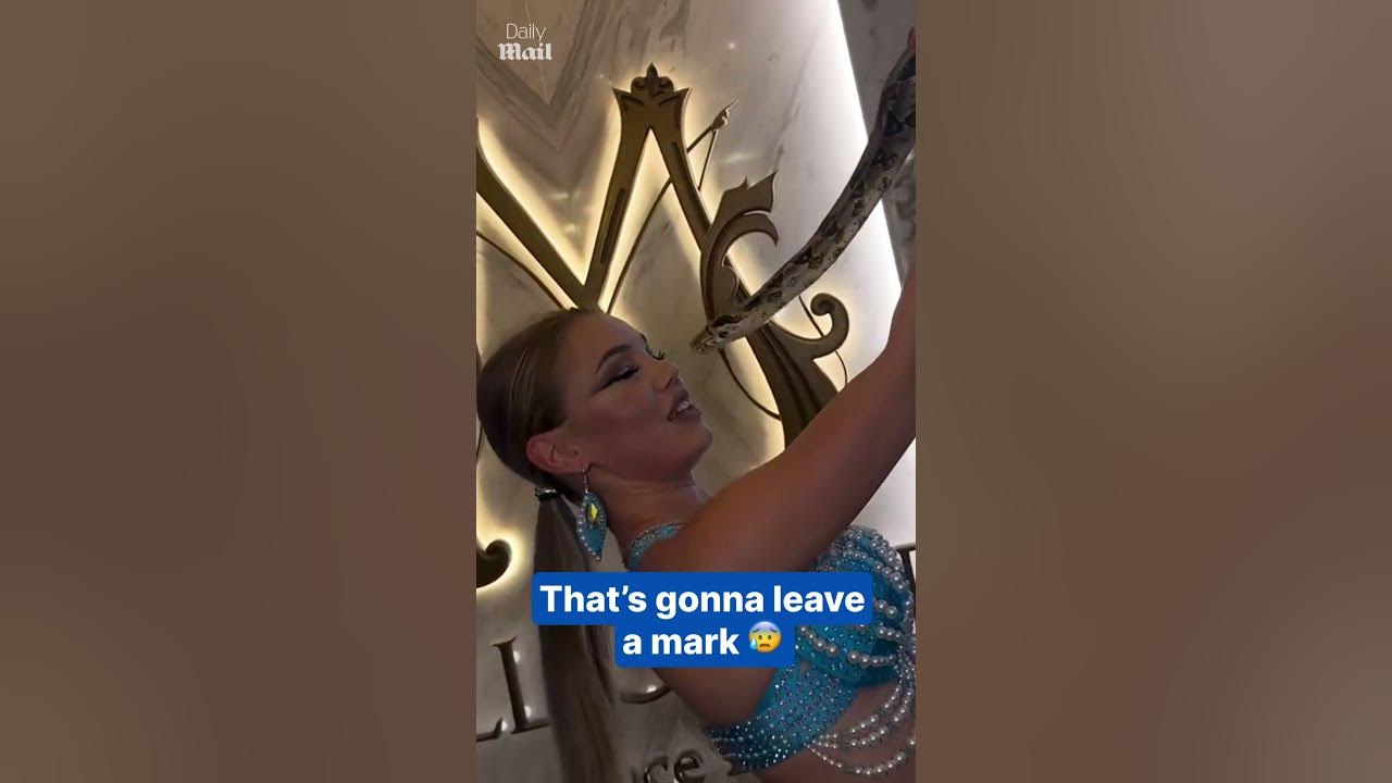 Dancer is bitten by snake