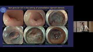 Basics in ESD. How to start?