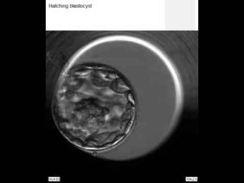 Video: Co znamená blastocysta?