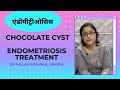 Endometriosis treatment  surgery  chocolate cyst   endometrioma     