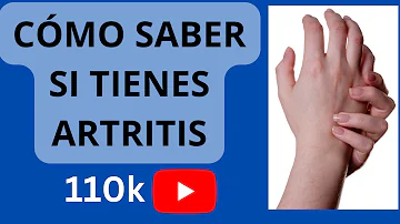 ¿Cómo sé si mi dolor se debe a la artritis?