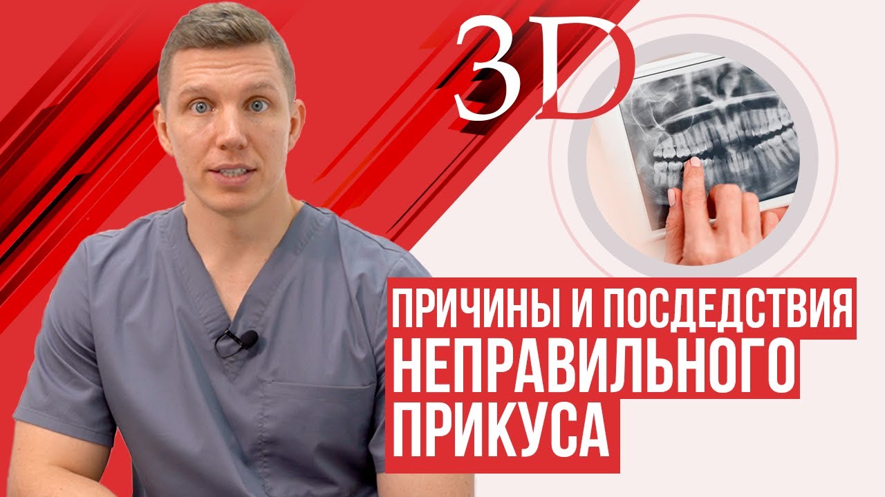 Неправильный прикус. Причины и последствия. - YouTube