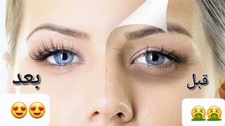 علاج تجاعيد الوجه تنظيف فوري للبشرة اقوى وصفة لإزالة الهالات السوداء من أول استعمال مضمونة ١٠٠٪?