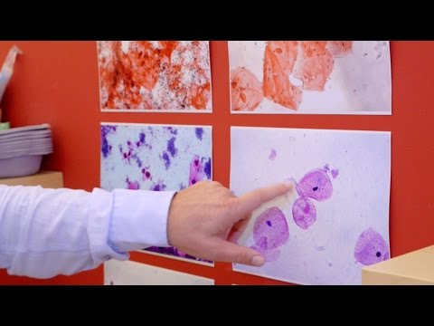 Video: Wachsen Laktobazillen auf Blutagar?