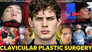 CLAVICULAR'S BOTCHED NOSE JOB: HE HAD SURGERY ON STREAM (THE DOCTOR UNCOVERED EVIDENCE OF DRUG USE)