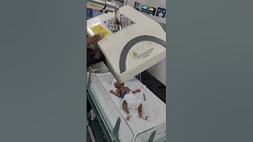 Phototherapy is a safe and effective treatment for severe jaundice in preterm babies