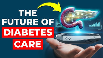 Automated Insulin Delivery - YOUR Future?