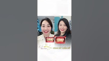 Làm Sứ có làm răng khểnh được không? Chuyên mục răng xinh p3