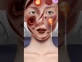 Face Infection Removing | Medical Surgical | Surgery Process #medicalsurgical