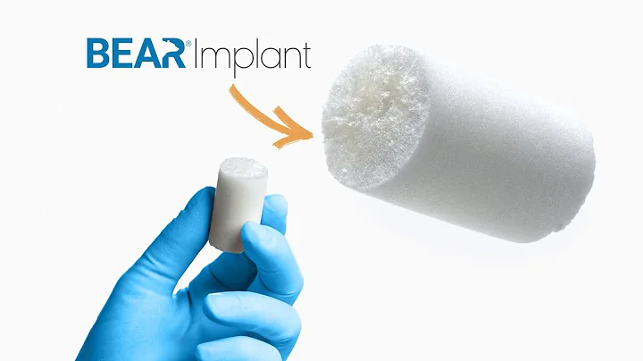 Heal Your ACL with the BEAR Implant | Miach Orthopaedics