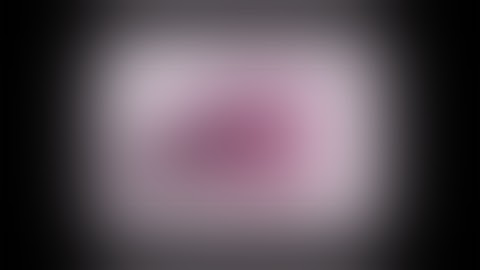 Dynamic Reconstruction of Deformable Soft-Tissue with Stereo Scope in Minimal Invasive Surgery