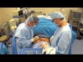 Male Tummy Tuck - BLUE Cosmetic Surgery - Chapter 2 - The Surgery