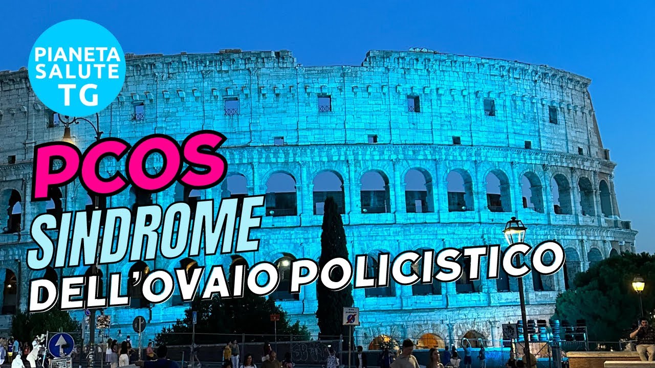 La Sindrome dell'ovaio policistico PCOS disturbo endocrino-ginecologico