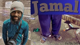 The skin is off my leg from my knee to my ankle - Jamal (USA FOX) Street Interview