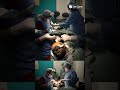 hair transplant full journey in few sec..