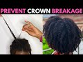 What Causes Sore Scalp? | How to Prevent Breakage at the Crown | CCCA