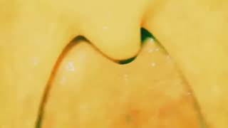 Starlas Mouth Zoom In Uvula