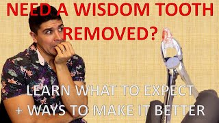 Does Wisdom Tooth Removal Hurt? What To Expect + How To Reduce The Pain by Dr Paul's Dental World 41,493 views 3 years ago 6 minutes, 42 seconds